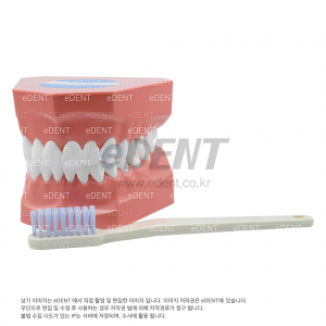 환자 설명용 모형