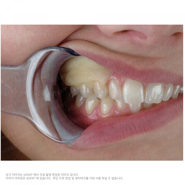 (주)이덴트 치과재료·치과의약품 전문,Reso-Pac Tube