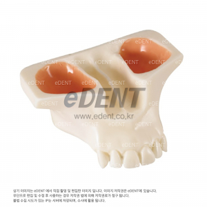 Sinus Model