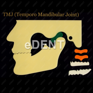 [교환/반품불가] TMD Simulator (환자설명용 턱관절 모델)