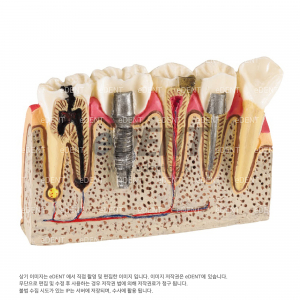 환자설명모델(Model STF)