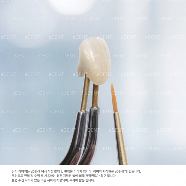 (주)이덴트 치과재료·치과의약품 전문,Jacket Grip