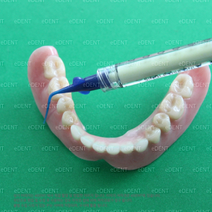 Denture Fit (비경화형 치과용 적합 시험재)