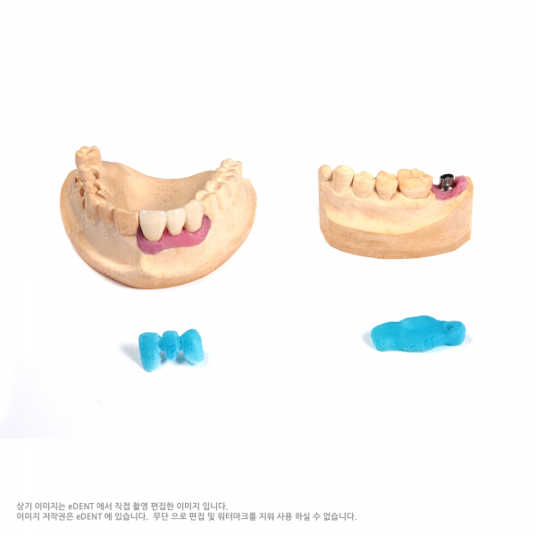 (주)이덴트 치과재료·치과의약품 전문,Alpha Implant Gum