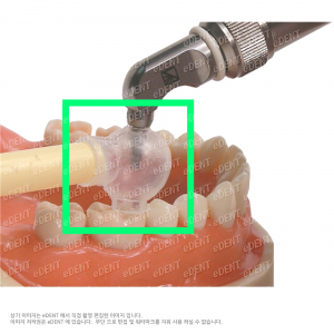 [교환/반품불가] Microetcher II A Sand trap