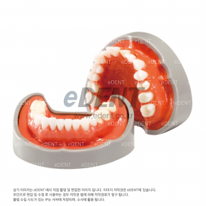 인레이크라운 카빙모델(Inlay-Crown Carving Model)