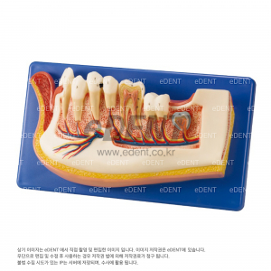 자이언트 모델 (Giant Model)