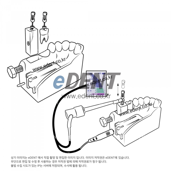 (주)이덴트 치과재료·치과의약품 전문,Endo Training Block