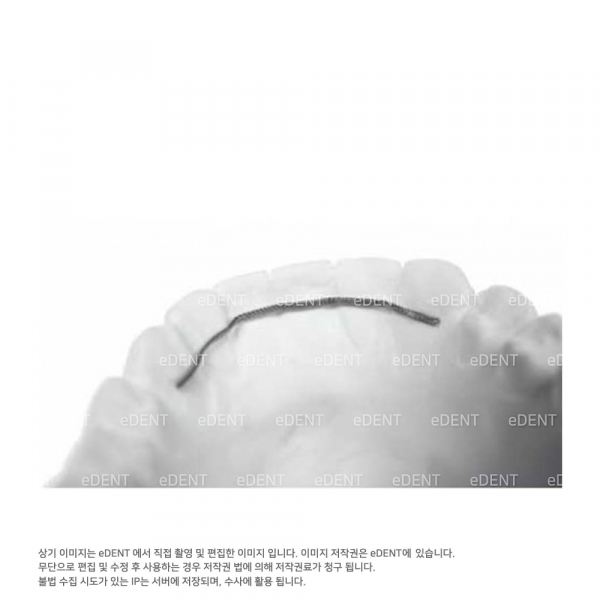 (주)이덴트 치과재료·치과의약품 전문,Stranded Retention Wire .0195