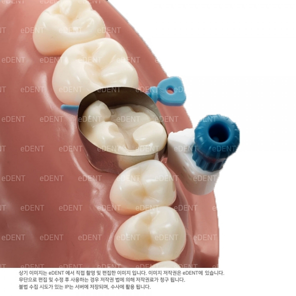 (주)이덴트 치과재료·치과의약품 전문,Palodent 360 Refill