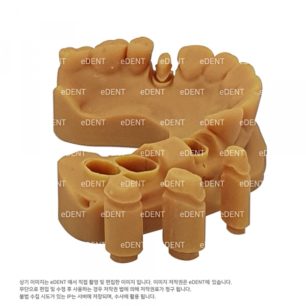(주)이덴트 치과재료·치과의약품 전문,ODS Model (3D 프린트 레진)