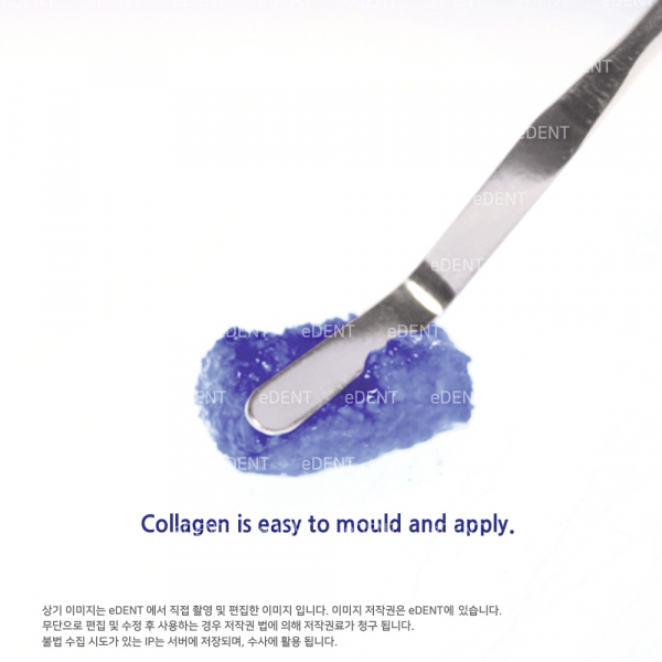 (주)이덴트 치과재료·치과의약품 전문,Bio-Oss Collagen