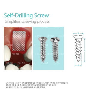 [교환/반품불가] GBR System Auto Screw (Mini self-drilling) (비멸균) [3~4일소요]