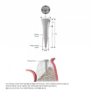 InnoGenic GBR Tenting Screw