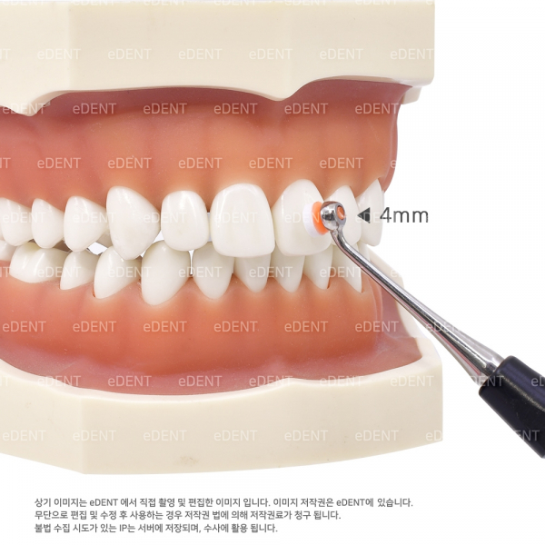 (주)이덴트 치과재료·치과의약품 전문,Composite Modeling Pad refill