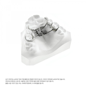 Leaf Spring Activated Expander