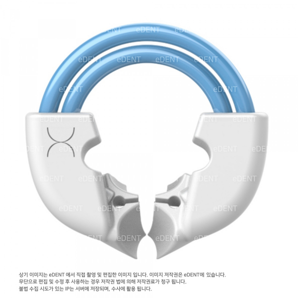 (주)이덴트 치과재료·치과의약품 전문,TwinRing Universal
