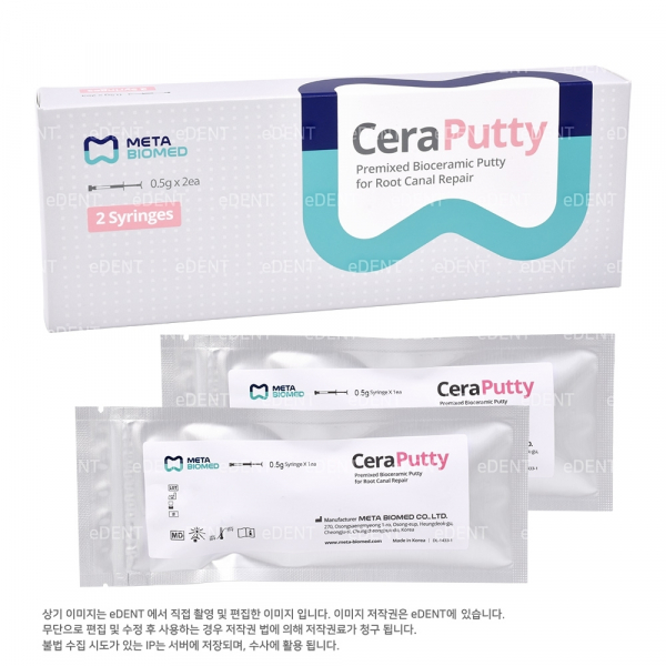 (주)이덴트 치과재료·치과의약품 전문,[1+1] CeraPutty