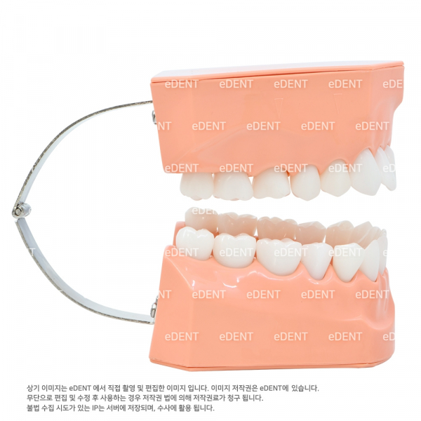 (주)이덴트 치과재료·치과의약품 전문,대형 양치 교육모델 (상악치아 2개 탈착가능)