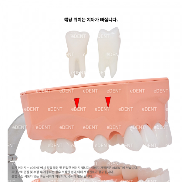 (주)이덴트 치과재료·치과의약품 전문,대형 양치 교육모델 (상악치아 2개 탈착가능)